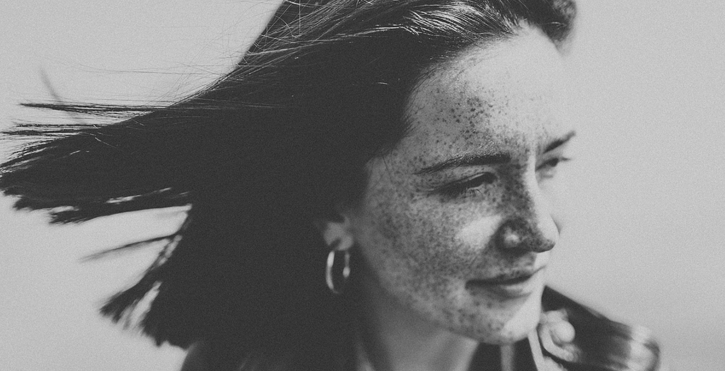 Hiperpigmentación durante el embarazo