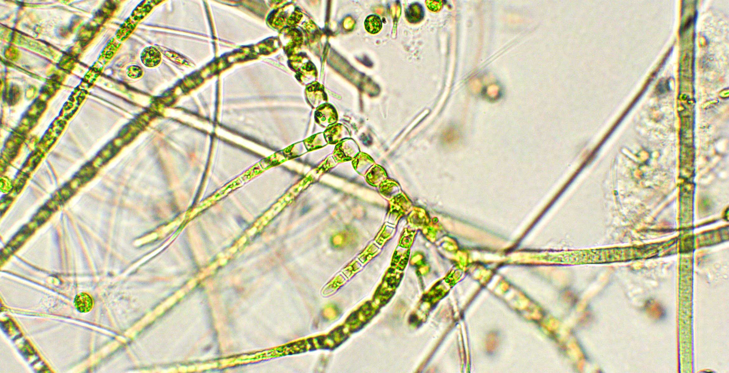 cuidar tu microbioma de la piel