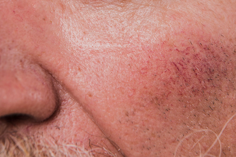 efectos de contaminacion en la piel