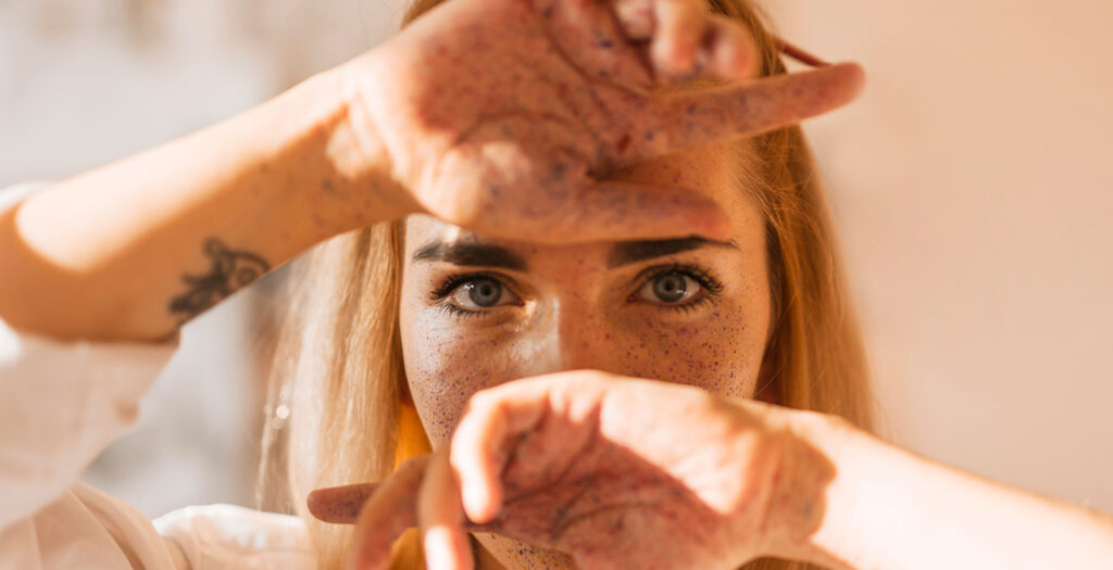 pigmentacion cutanea Twelve Beauty