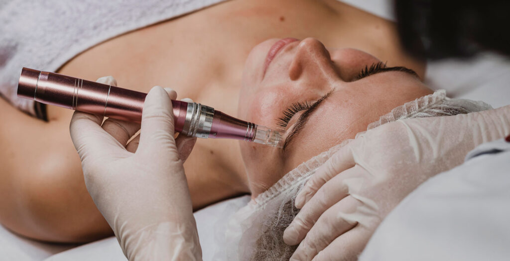 pros y contras de microneedling
