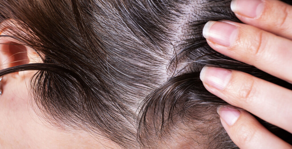 un cuero cabelludo sano twelve beauty